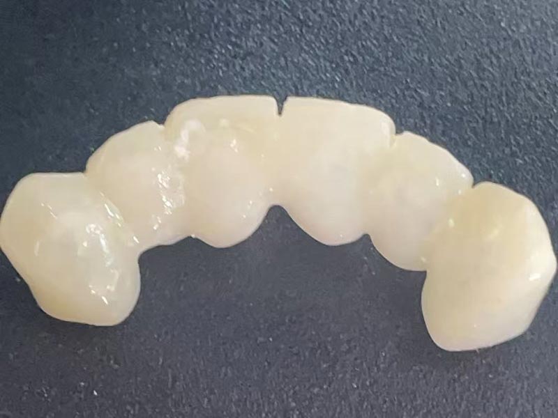 Что такое «Временная корона»? Зачем он вам нужен?