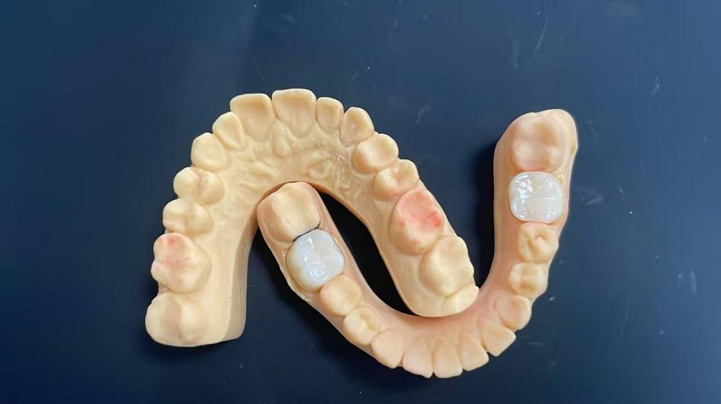 Что такое плечевой край?