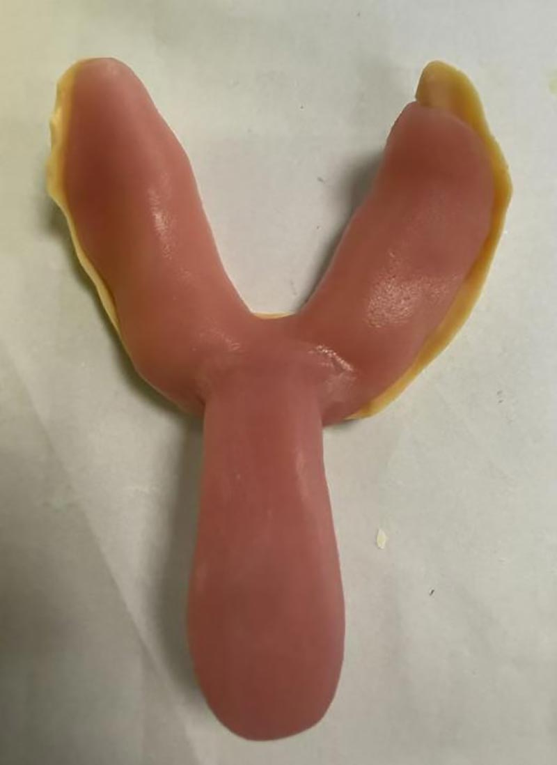 Вещи, которые вы не знали об индивидуальных стоматологических каппах