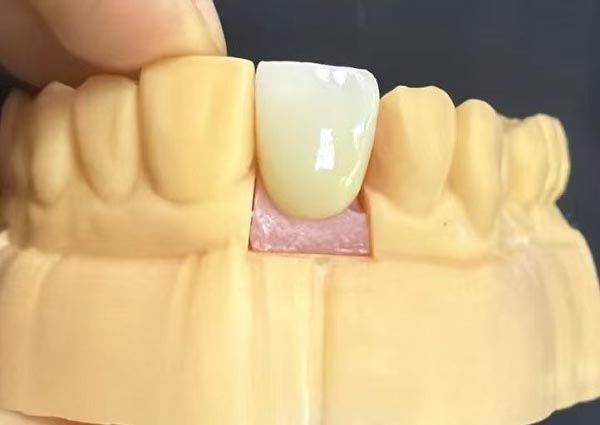 Промежутки между зубами можно исправить: прямые зубы самые привлекательные!