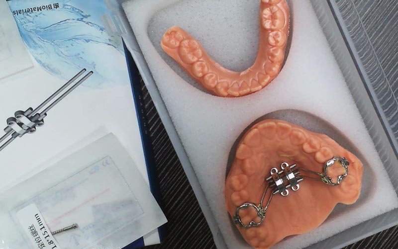 Понимание расширения скелета MSE с помощью WM Dental Lab