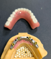 Локатор и стоматологическая штанга